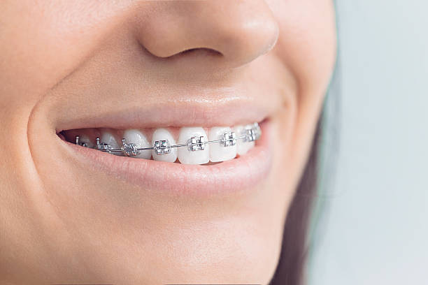 Best Dental Inlays and Onlays  in Fairview Shores, FL